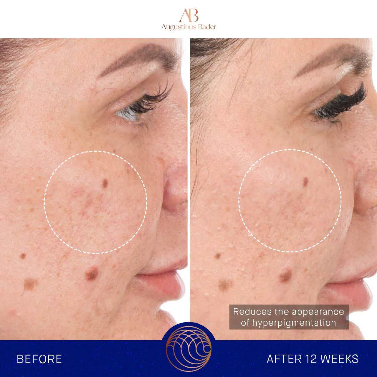 Mini The Retinol Serum