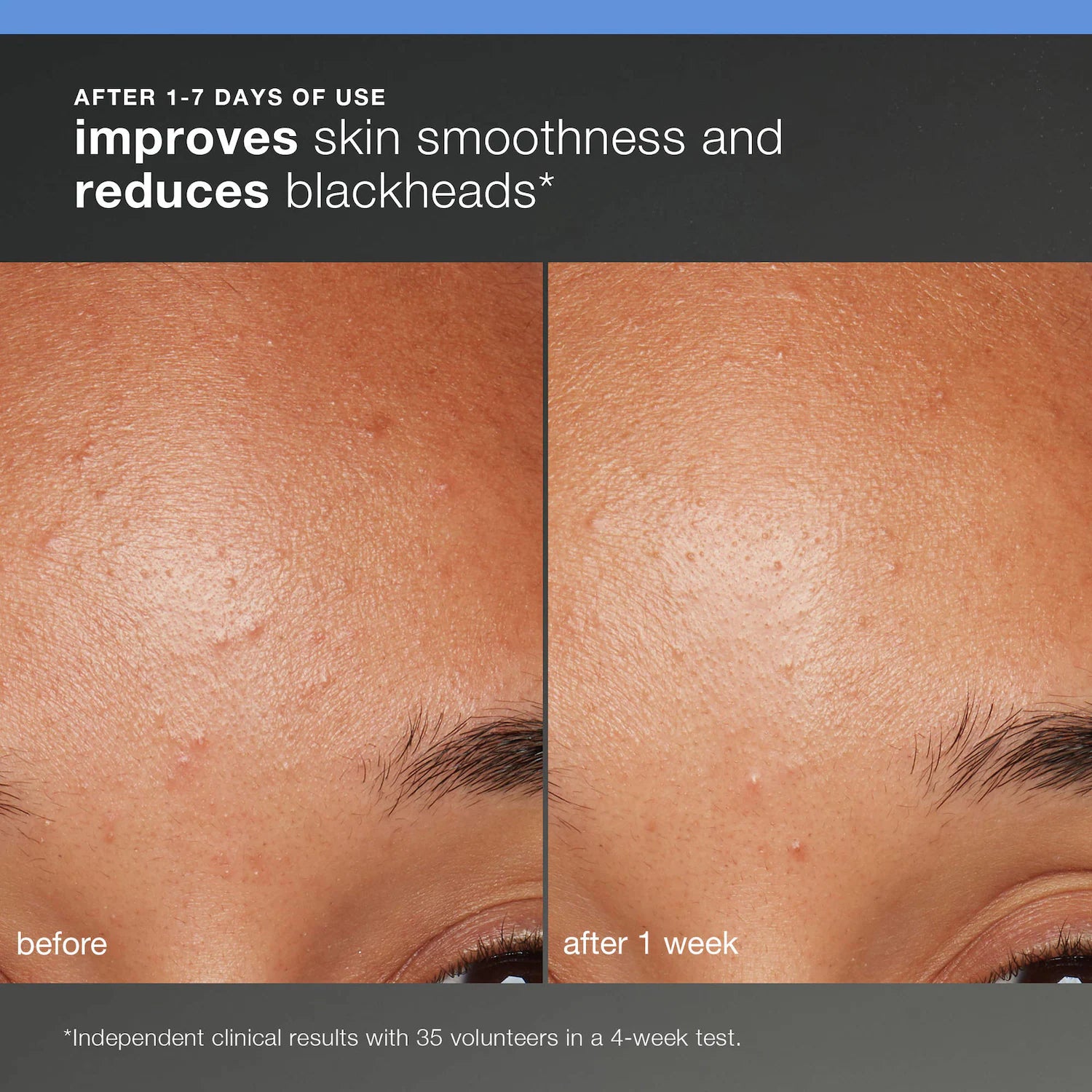 Dermalogica Discover Healthy Skin Kit