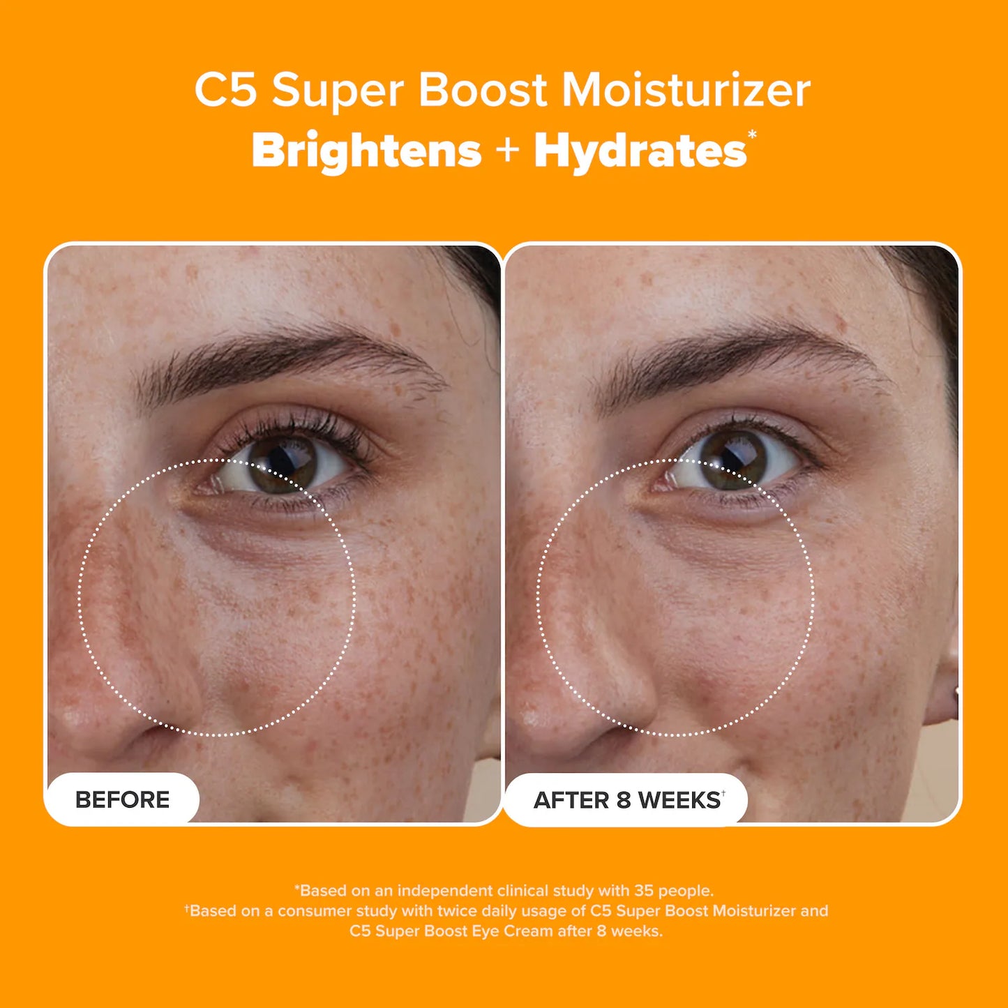 C5 Super Boost Vitamin C Moisturizer