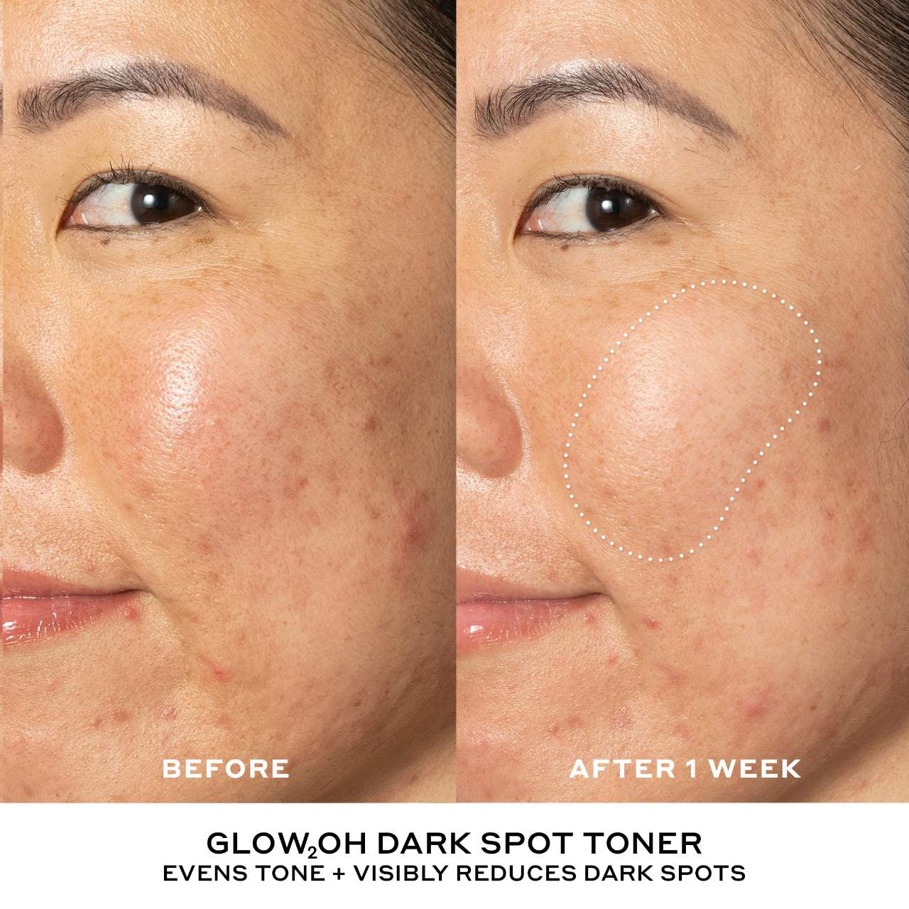 The Glow Cycle Skincare Set