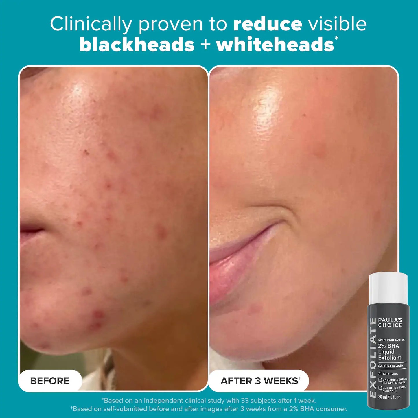 Exfoliation Icons Kit for clear, brighter looking skin