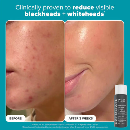 Exfoliation Icons Kit for clear, brighter looking skin